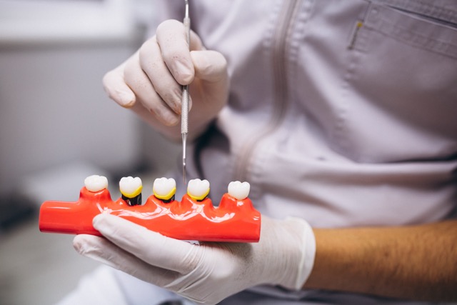 What to Do Before and After Wisdom Teeth Removal - img 2 - Blog VIP Dental Care