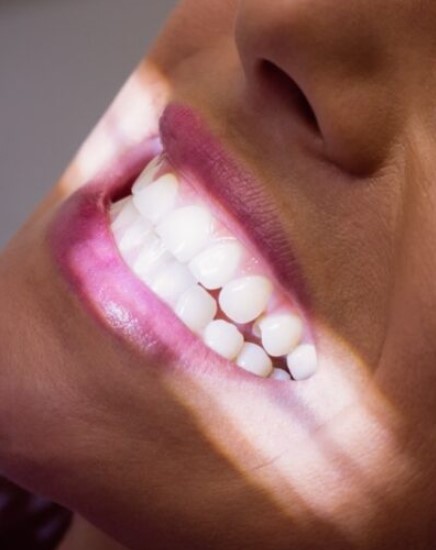 Professional teeth whitening treatment cost and options
